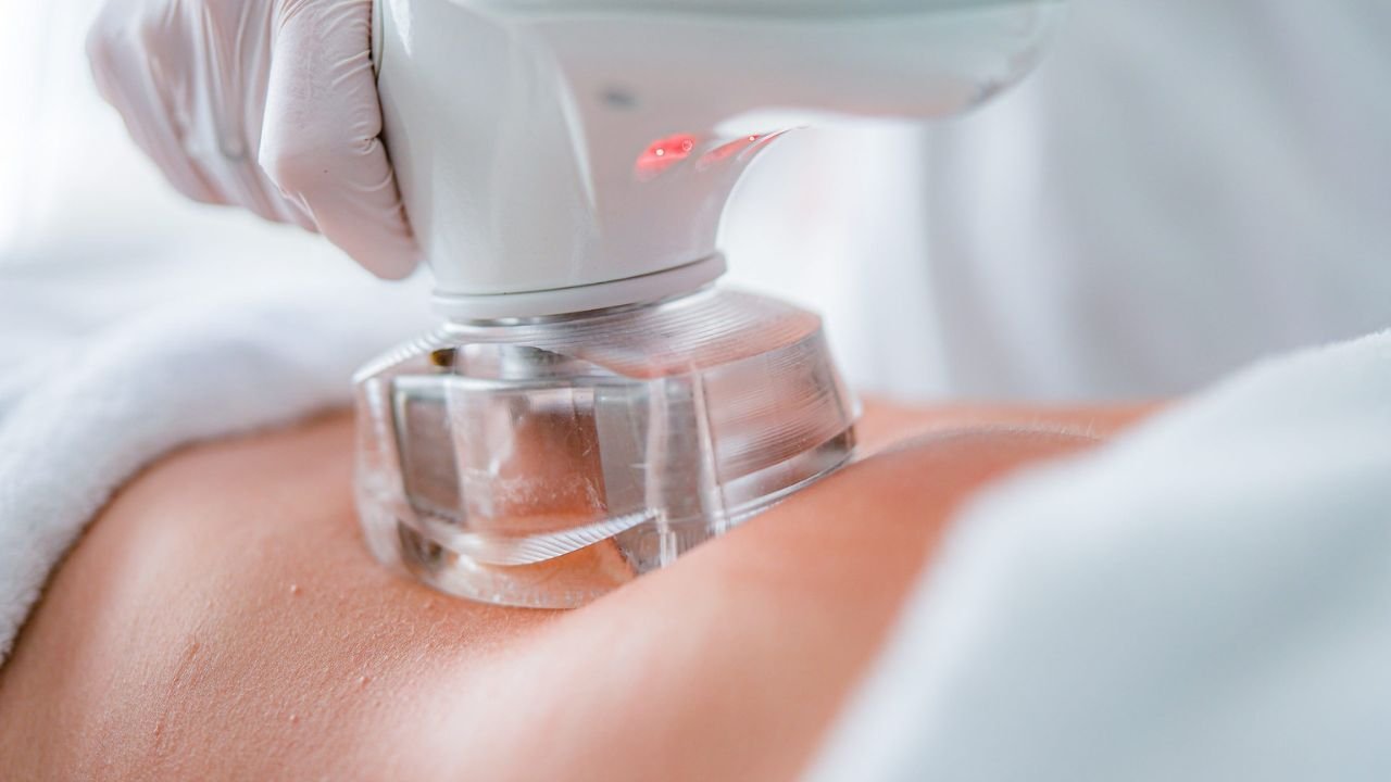 SHED UP 3 TO 7 Centimeter  IN A SINGLE SESSION with Eximia