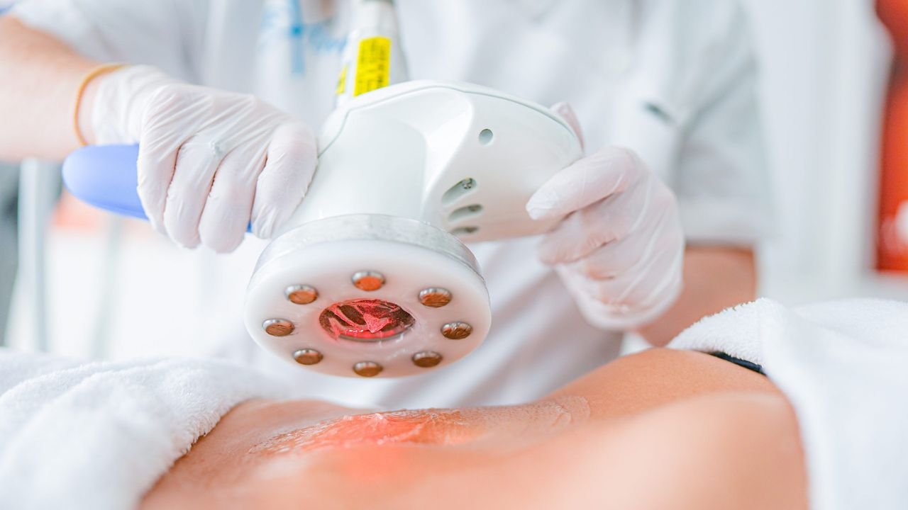 SHED UP 3 TO 7 Centimeter  IN A SINGLE SESSION with Eximia